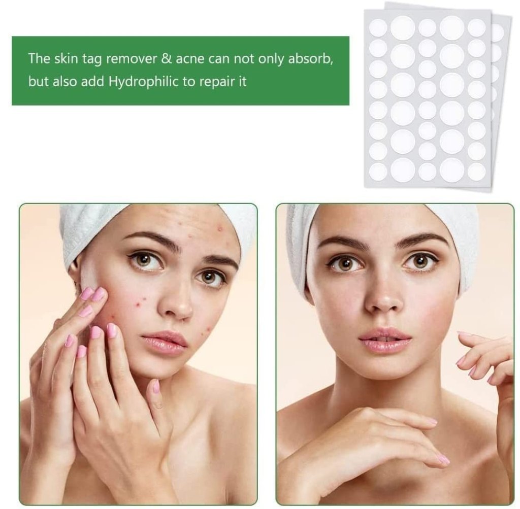 Acne Pimple Patches – Hydrocolloid Dots for Spots (Pack of 3, 108 pcs) Invisible | Waterproof | Fast Healing(Pack of 3 = 108 Spots/Pcs) - Elneor