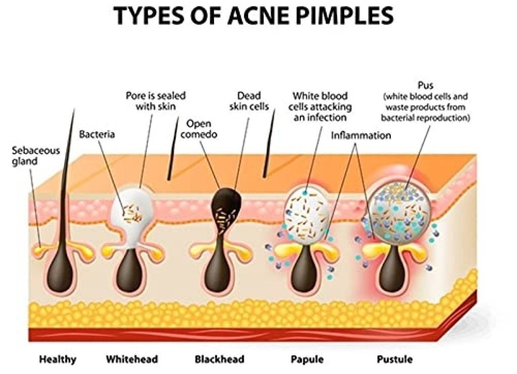 Elneor Premium Product - Elneor Decor